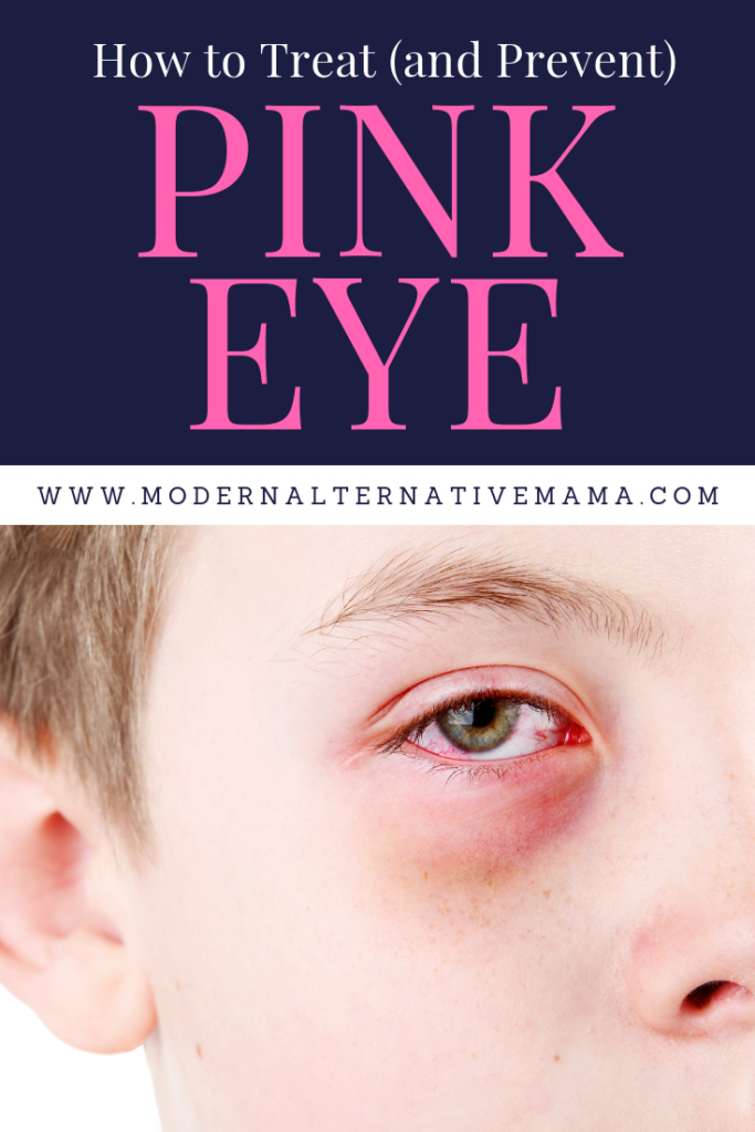 How to Treat (and Prevent) Pink Eye