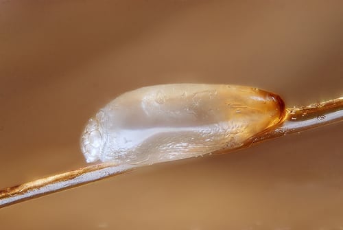 Human head louse egg