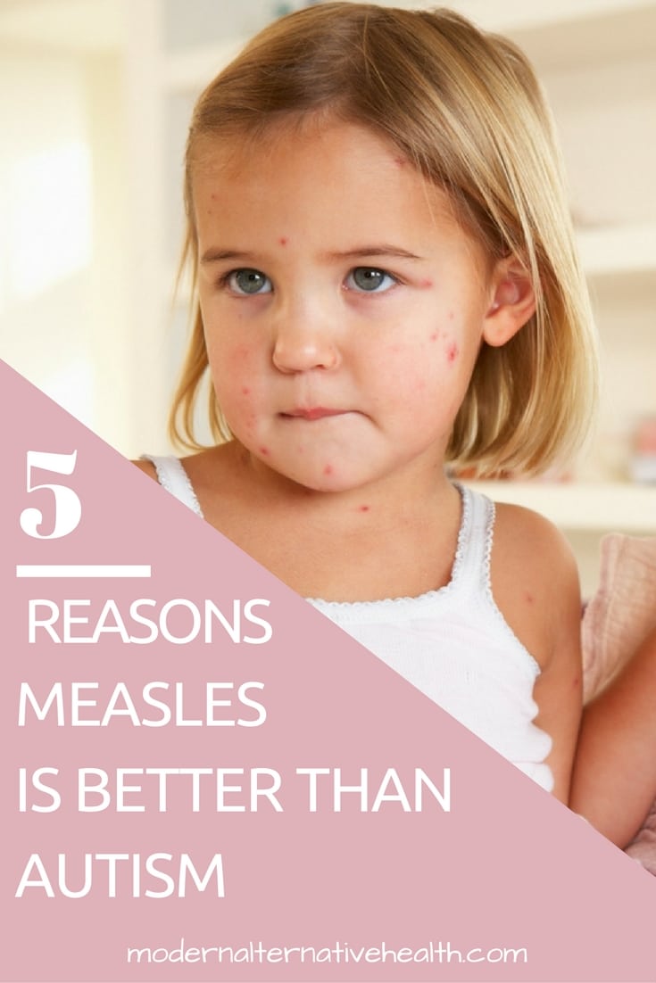Five Reasons Measles is Better Than Autism