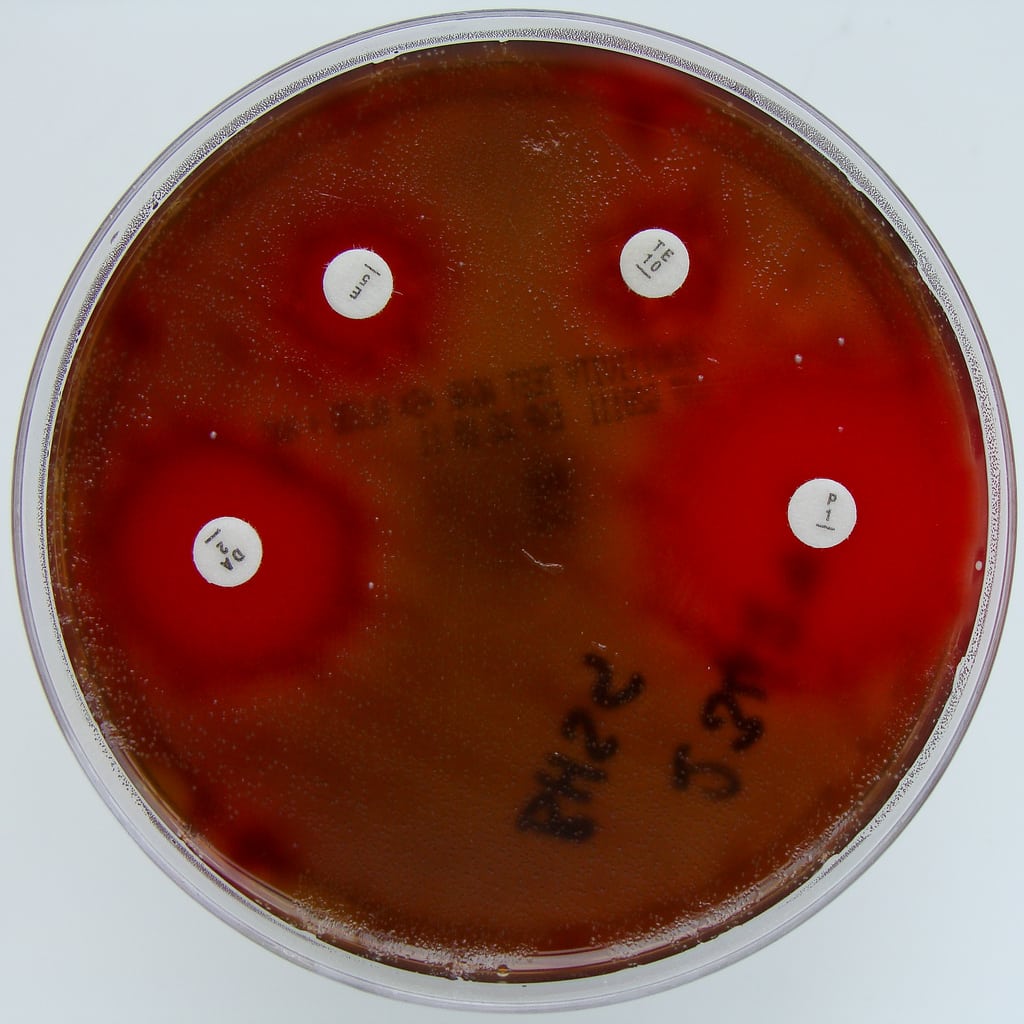 Inducible macrolide resistance - D-test Streptococcus agalactiae