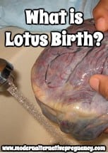 What is Lotus Birth?