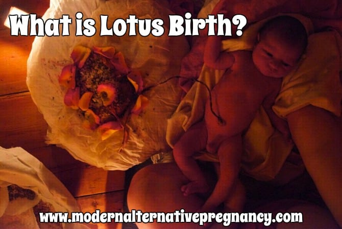What is Lotus Birth?