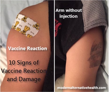 10 Signs of Vaccine Reaction and Damage