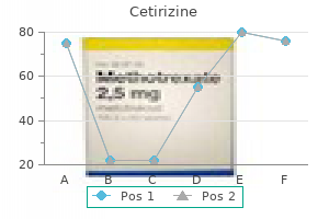 order 10 mg cetirizine mastercard