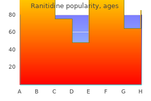 generic ranitidine 300mg fast delivery