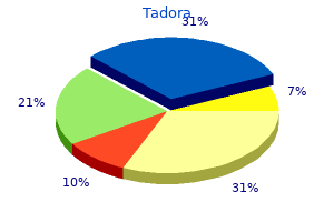 order tadora line