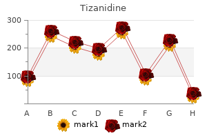 order tizanidine 2 mg with visa