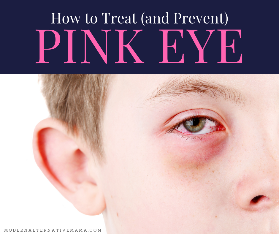 how-to-treat-and-prevent-pink-eye